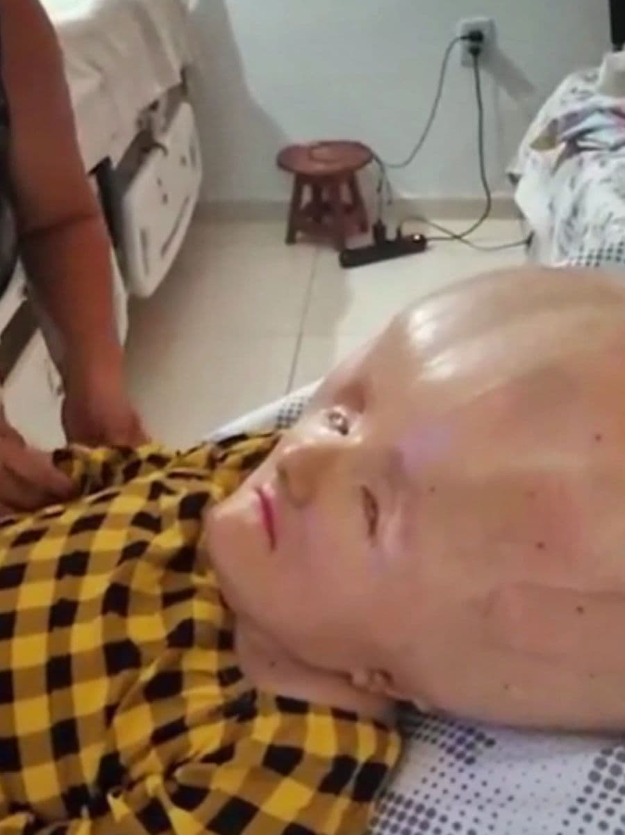 This american child was abandoned because he looked like an alien, but five years later, everyone who mocked him was left speechless. #alien #boy #abandoned  #hopecore #sadstory 