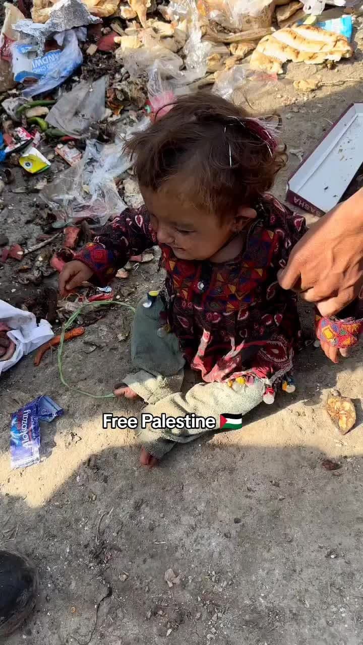 Satu dari sekian ribu anak anak di palestine terlantar dengan kondisi kelaparan ,sakit kulit dan butuh nutrisi ... Kemanakah keadilan dunia untuk kami !!  #gazachildren #reality #reaction #updategaza #donat 